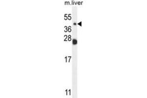 Western Blotting (WB) image for anti-Sialidase 4 (NEU4) antibody (ABIN2995626) (Sialidase 4 抗体)