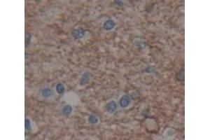 IHC-P analysis of Human Tissue, with DAB staining. (Metabotropic Glutamate Receptor 1 抗体  (AA 165-592))