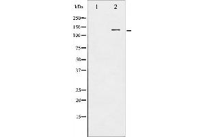 Western blot analysis of CBL phosphorylation expression in Na2VO3 treated HepG2 whole cell lysates,The lane on the left is treated with the antigen-specific peptide. (CBL 抗体  (pTyr674))