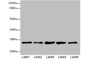 Western blot All lanes: RAB9A antibody at 7. (RAB9A 抗体  (AA 122-201))