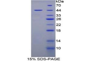 SDS-PAGE analysis of Rat MEC Protein. (Mucosae Associated Epithelia Chemokine 蛋白)
