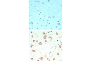 Image no. 1 for anti-K(lysine) Acetyltransferase 5 (KAT5) (AA 480-530) antibody (ABIN960242) (KAT5 抗体  (AA 480-530))