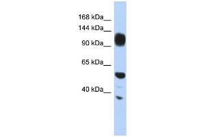 WB Suggested Anti-WDHD1 Antibody Titration: 0.