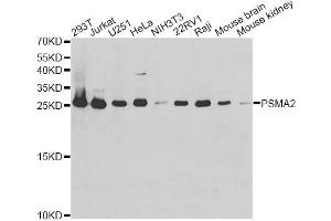 Western blot analysis of extracts of various cell lines, using PSMA2 antibody. (PSMA2 抗体)