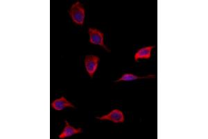 ABIN6265218 and ABIN6277933 staining HepG2 by IF/ICC.
