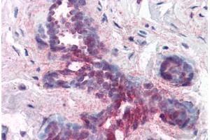 Human Breast (formalin-fixed, paraffin-embedded) stained with PDCD4 antibody ABIN214444 at 1. (PDCD4 抗体  (pSer457))