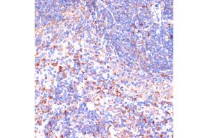 Immunohistochemistry (IHC) image for anti-Von Hippel-Lindau Tumor Suppressor, E3 Ubiquitin Protein Ligase (VHL) (AA 1-172) antibody (ABIN3020968)