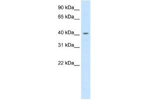 WB Suggested Anti-PPARD Antibody Titration:  0. (PPARD 抗体  (C-Term))