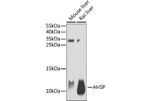 Western blot analysis of extracts of various cell lines, using AHSP antibody (ABIN6131912, ABIN6136672, ABIN6136673 and ABIN6222122) at 1:1000 dilution. (aHSP 抗体  (AA 1-102))