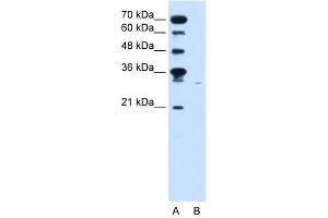 WB Suggested Anti-SLC22A7  Antibody Titration: 0. (SLC22A7 抗体  (C-Term))