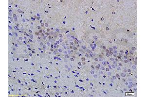Formalin-fixed and paraffin embedded rat kidney tissue labeled with Anti phospho-MAP3K9+MAP3K10(Thr312+Thr266) Polyclonal Antibody, Unconjugated (ABIN872294) at 1:200 followed by conjugation to the secondary antibody and DAB staining (MAP3K9 抗体  (pThr312))