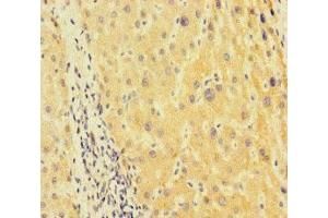 Immunohistochemistry (IHC) image for anti-Tubulin, alpha 1B (TUBA1B) (AA 29-310) antibody (ABIN7173655)