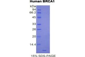SDS-PAGE (SDS) image for Breast Cancer 1 (BRCA1) (AA 19-83) protein (His tag) (ABIN1877581) (BRCA1 Protein (AA 19-83) (His tag))