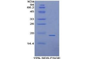 SDS-PAGE (SDS) image for Annexin A4 (ANXA4) ELISA Kit (ABIN6720590)