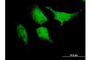 Immunofluorescence of purified MaxPab antibody to TRAF6 on HeLa cell. (TRAF6 抗体  (AA 1-522))