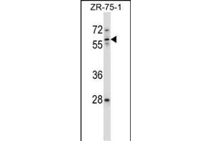 IC Antibody (Center) (ABIN657631 and ABIN2846627) western blot analysis in ZR-75-1 cell line lysates (35 μg/lane). (ICAM-3/CD50 抗体  (AA 282-310))
