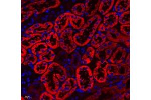 Immunofluorescence (Paraffin-embedded Sections) (IF (p)) image for anti-Aldehyde Dehydrogenase 4 Family, Member A1 (ALDH4A1) antibody (ABIN7073000)