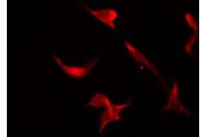 ABIN6266451 staining HeLa by IF/ICC. (CDC25A 抗体  (pSer76))