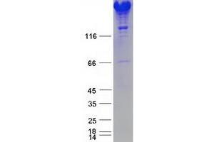 Validation with Western Blot