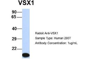 Host:  Rabbit  Target Name:  VSX1  Sample Type:  Human 293T  Antibody Dilution:  1. (VSX1 抗体  (Middle Region))