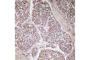 Immunohistochemistry (IHC) image for anti-ATP Synthase, H+ Transporting, Mitochondrial F1 Complex, gamma Polypeptide 1 (ATP5C1) antibody (ABIN7302812)