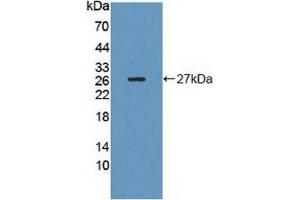 Western blot analysis of recombinant Human Grb10. (GRB10 抗体  (AA 392-594))