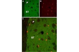 Expression of Muscarinic acetylcholine receptor M1 in rat striatum - Immunohistochemical staining of rat striatum (ST) using Anti-CHRM1 Antibody (ABIN7043060, ABIN7044580 and ABIN7044581). (CHRM1 抗体  (AA 227-353))