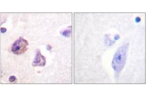 Immunohistochemistry analysis of paraffin-embedded human brain, using FAK (Phospho-Tyr576) Antibody. (FAK 抗体  (pTyr576))