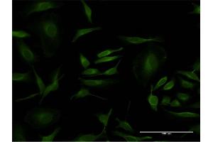 Immunofluorescence of monoclonal antibody to PCNA on HeLa cell. (PCNA 抗体  (AA 78-177))