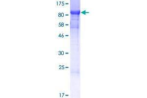 Image no. 1 for SHQ1 Homolog (SHQ1) (AA 1-577) protein (GST tag) (ABIN1319967)