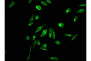 Immunofluorescence staining of Hela cells with ABIN7139270 at 1:2. (HIST1H2AG 抗体  (2meArg11))
