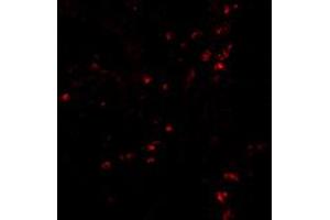 Immunofluorescence of LAMP1 in human colon tissue with LAMP1 polyclonal antibody  at 20 ug/mL . (LAMP1 抗体  (Internal Region))