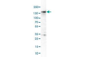 Western Blot (Cell lysate) analysis of HL-60 cell lysate. (MKL1 抗体)
