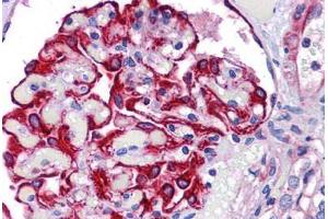 Human Kidney: Formalin-Fixed, Paraffin-Embedded (FFPE) (FREM2 抗体  (Internal Region))