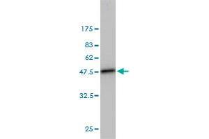Western Blot detection against Immunogen (42. (UBE2L3 抗体  (AA 1-154))