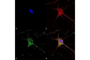 Immunocytochemistry/Immunofluorescence analysis using Mouse Anti-SUR1 Monoclonal Antibody, Clone S289-16 (ABIN1027723). (ABCC8 抗体  (AA 1548-1582))