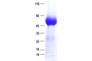 Validation with Western Blot (IL1RL1 Protein (DYKDDDDK Tag))