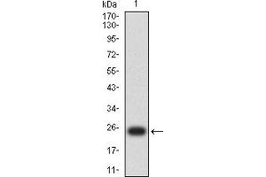 Western blot analysis using S100B mAb against human S100B (AA: 1-92) recombinant protein. (S100B 抗体  (AA 1-92))