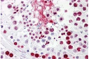 Anti-HNRNPL / hnRNP L antibody IHC staining of human testis. (HNRNPL 抗体  (AA 61-110))