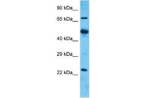 Host:  Rabbit  Target Name:  MARCH7  Sample Type:  Uterus Tumor lysates  Antibody Dilution:  1. (MARCH7 抗体  (N-Term))