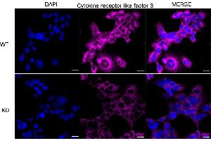 Immunocytochemical staining of HeLa cells using Cytokine receptor like factor 3 antibody (ABIN7798262), 1:1,000), Top panel: wild-type (WT), Bottom panal: Cytokine receptor like factor 3 shRNA knockdown (KD). (CRLF3 抗体)