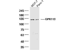 Lane 1: MCF-7 Cell lysates, Lane 2: Panc-1 Cell lysates, probed with GPR113 Polyclonal Antibody, unconjugated  at 1:300 overnight at 4°C followed by a conjugated secondary antibody for 60 minutes at 37°C. (GPR113 抗体  (AA 1-100))