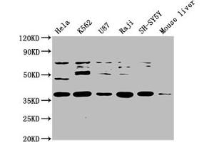 Western Blot Positive WB detected in: Hela whole cell lysate, K562 whole cell lysate, U87 whole cell lysate, Raji whole cell lysate, SH-SY5Y whole cell lysate, Mouse liver tissue All lanes: SS18L1 antibody at 1:2000 Secondary Goat polyclonal to rabbit IgG at 1/50000 dilution Predicted band size: 43, 41, 34, 30, 44 kDa Observed band size: 43 kDa (SS18L1 抗体  (AA 47-396))