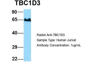 Host: Rabbit Target Name: TBC1D3 Sample Type: Human Jurkat Antibody Dilution: 1. (TBC1D3 抗体  (C-Term))