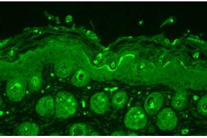 Immunohistochemistry analysis using Rabbit Anti-Ubiquitin Polyclonal Antibody . (Ubiquitin 抗体  (PerCP))