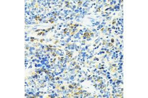 Immunohistochemistry of paraffin-embedded rat spleen using SLC25 antibody (ABIN6132660, ABIN6147903, ABIN6147904 and ABIN6224187) at dilution of 1:100 (40x lens). (SLC25A11 抗体  (AA 1-314))