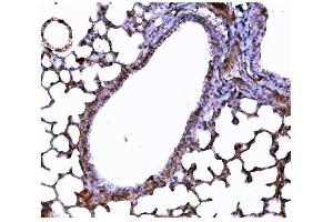 IHC analysis of Superoxide Dismutase 3/EC-SOD/Sod3 using anti-Superoxide Dismutase 3/EC-SOD/Sod3 antibody (ABIN7601457).