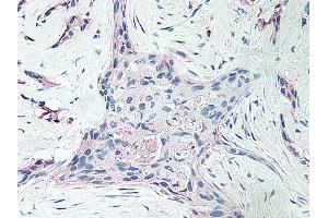 Image no. 1 for anti-Platelet Factor 4 (PF4) antibody (ABIN465152) (PF4 抗体)