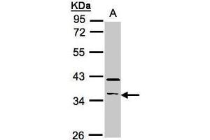 WB Image Sample(30 ug whole cell lysate) A:Raji , 10% SDS PAGE antibody diluted at 1:500 (RASSF2 抗体  (Center))