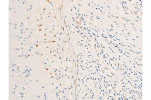 ABIN6267234 at 1/100 staining human TB tissue sections by IHC-P.